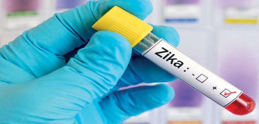 علماء يتوقعون انتهاء عدوى فيروس زيكا خلال عامين أو ثلاثة