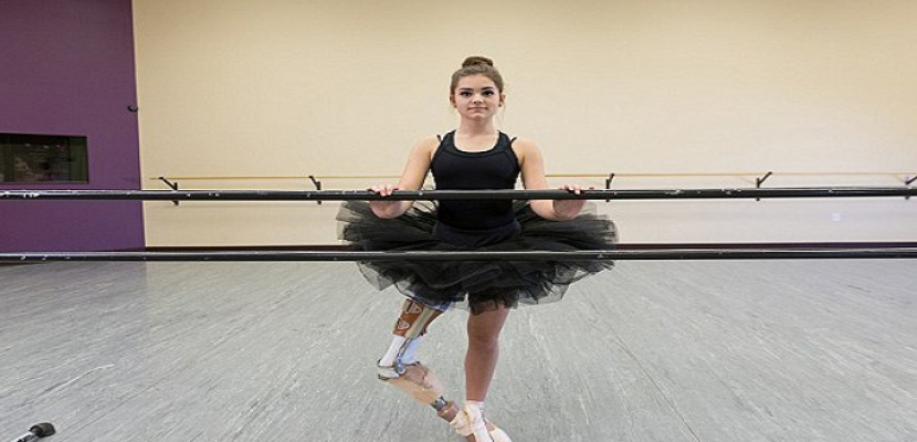 طالبة أمريكية تتحدى الإعاقة لتصبح أشهر راقصة باليه بعد بتر ساقيها