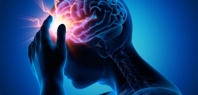90 % من حالات الإصابة بالسكتة الدماغية يمكن تجنبها
