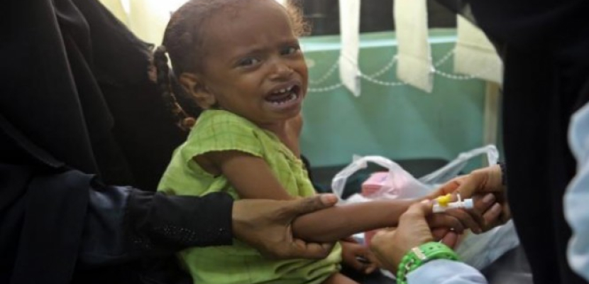 الأمم المتحدة : أزمة اليمن الأسوأ في العالم