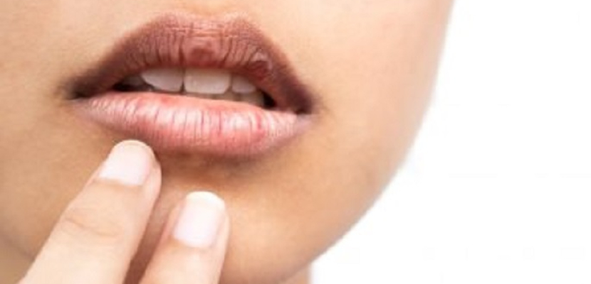 وصفات طبيعية لعلاج الجفاف حول الفم