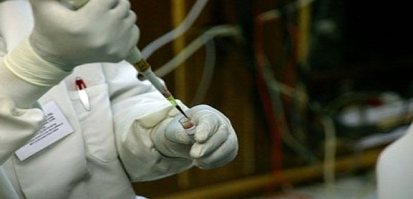 علماء ألمان ينجحون في إزالة «الإيدز» من الدم