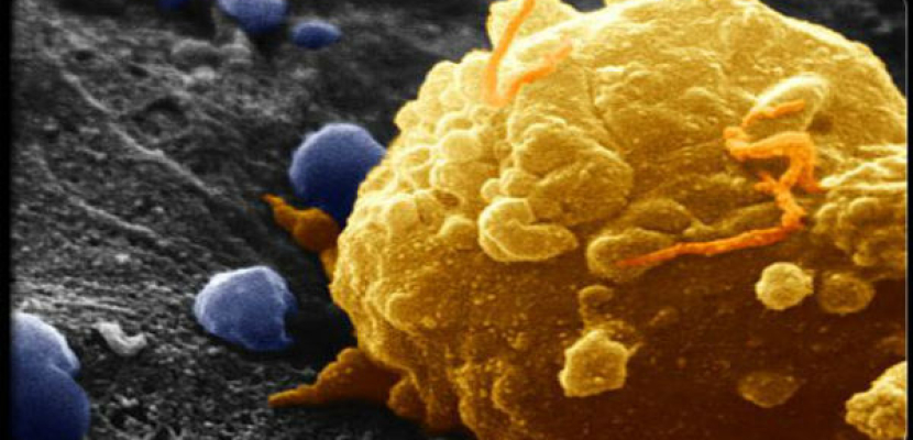 باحثة مصرية تنجح في عزل بكتريا تحتوي إنزيمات لعلاج سرطان الثدي