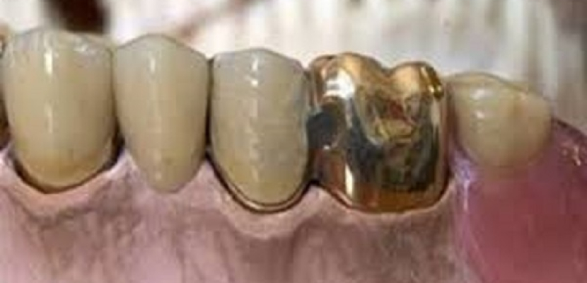 ترسبات الرصاص على الأسنان تكشف أسرار حياة الإنسان