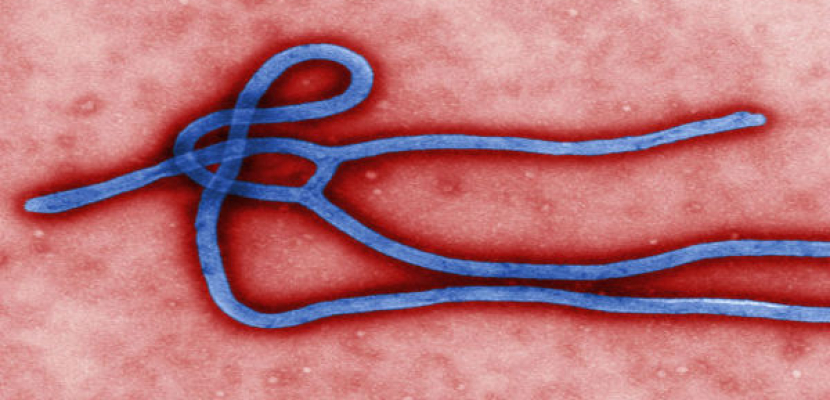 الجيش الأمريكى يشرف على أحدث طرق علاج فيروس الإيبولا