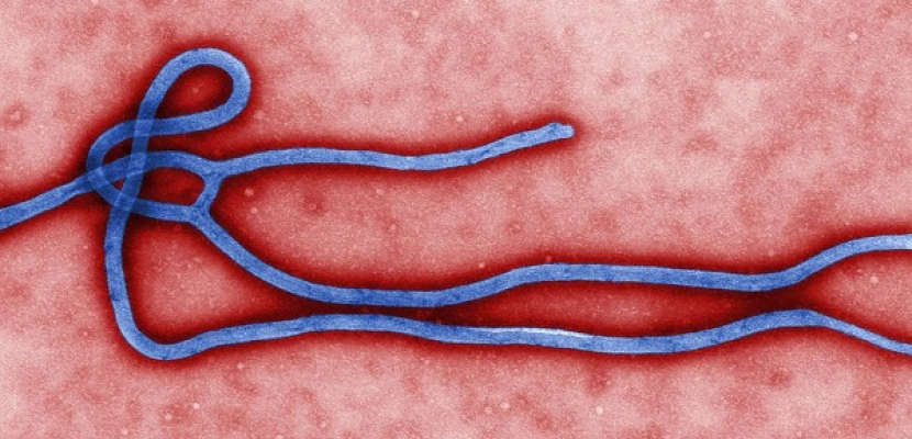 علماء يستبعدون انتقال “إيبولا” عبر الهواء