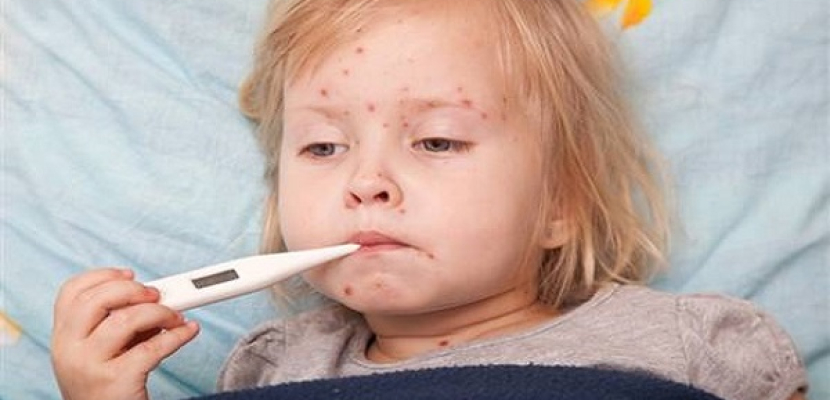 الصحة العالمية تطالب أوروبا بتكثيف التطعيم ضد الحصبة