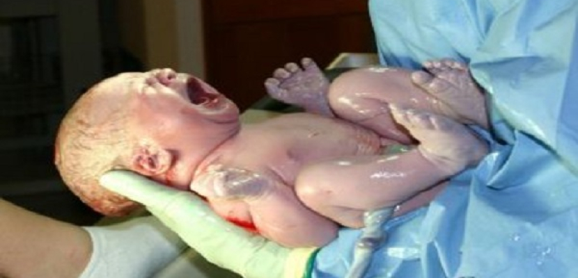 دراسة أمريكية تسلط الضوء على مخاطر الولادة القيصرية