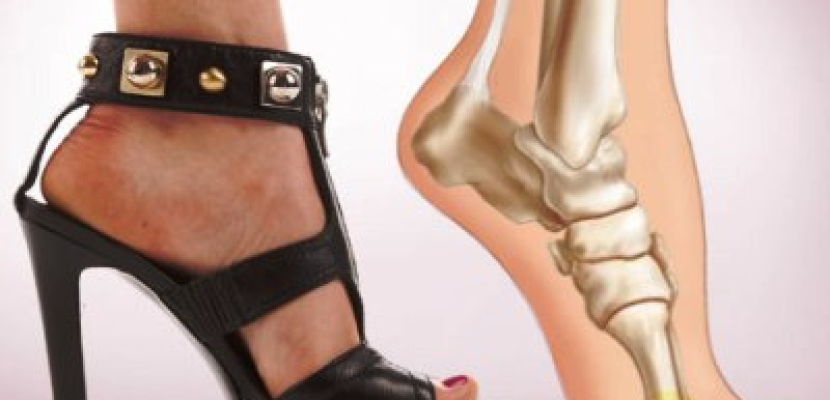 6 طرق للتغلب على ألم القدمين بعد ارتداء الكعب العالى