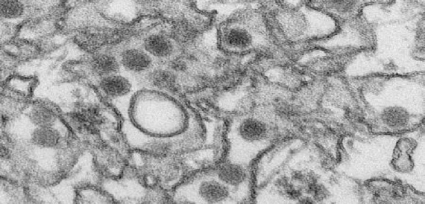 منظمة الصحة العالمية تتوقع إصابة 4 ملايين حالة بفيروس “زيكا”