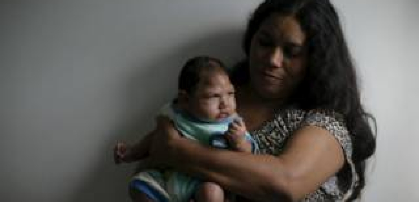 دراسة برازيلية لبحث الصلة بين فيروس زيكا وصغر حجم رأس حديثي الولادة