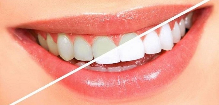 وصفة بسيطة لحماية أسنانك من الاصفرار.. تعرفي عليها؟