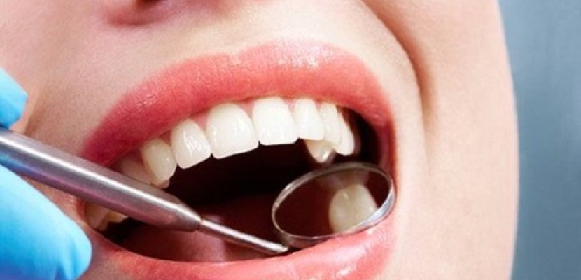 جل جديد يعمل على منع تسوس الأسنان