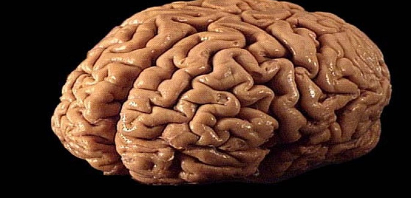 دراسة: القرارات الأخلاقية مرتبطة بنشاط المخ