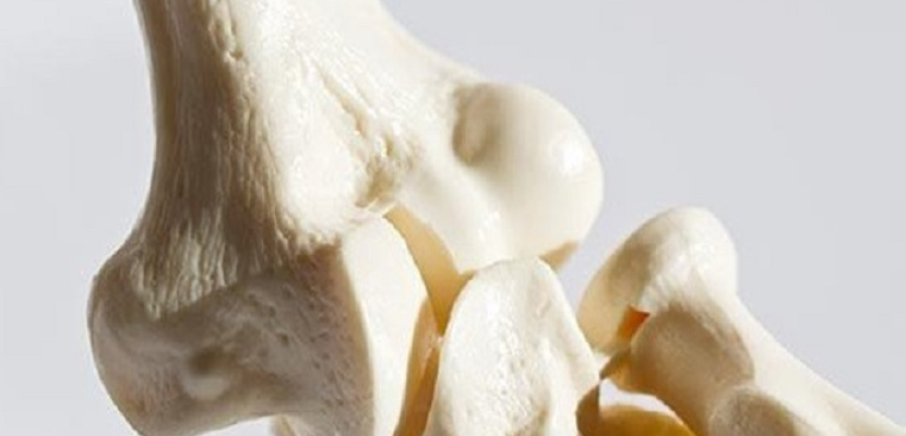 دراسة تؤكد أن العظام تتعرض للبدانة !!