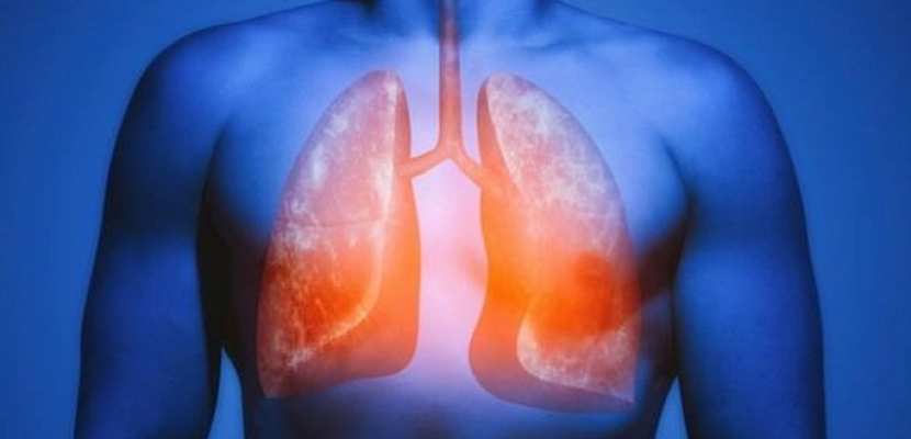دراسة جديدة: الرئة لديها قدرة “سحرية” لإصلاح نفسها وتمنع الخلايا السرطانية بعد ترك التدخين