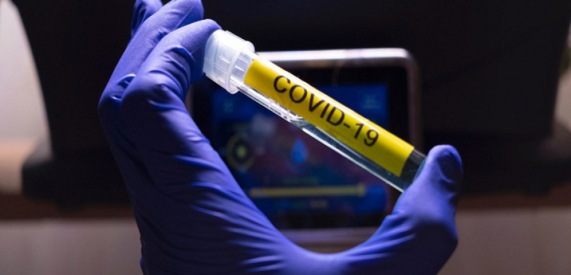 جامعة روسية تستكمل اختبارات لقاح مضاد لفيروس كورونا بنجاح