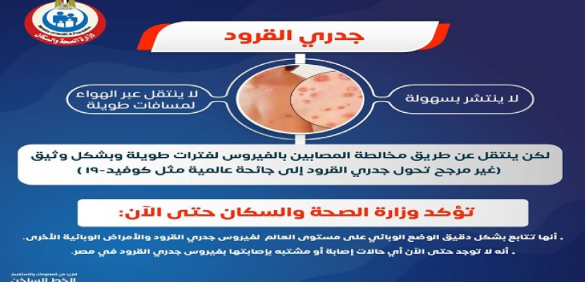 وزارة الصحة تؤكد خلو مصر من أية إصابات بفيروس جدري القرود