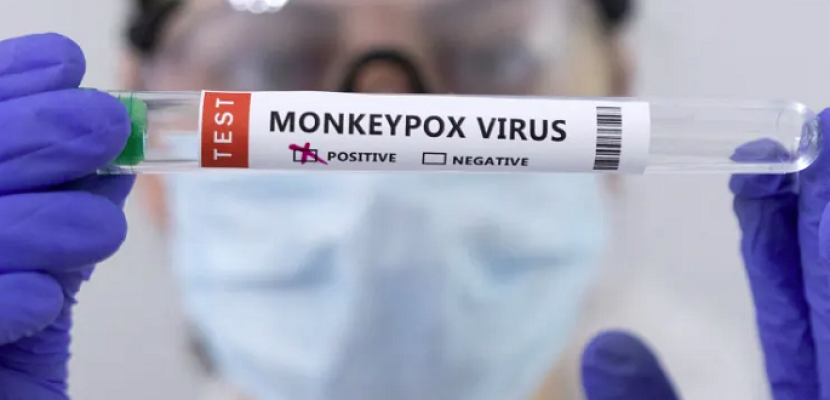 الصحة الأمريكية تسمح بطريقة حقن جديدة للقاح جدري القردة