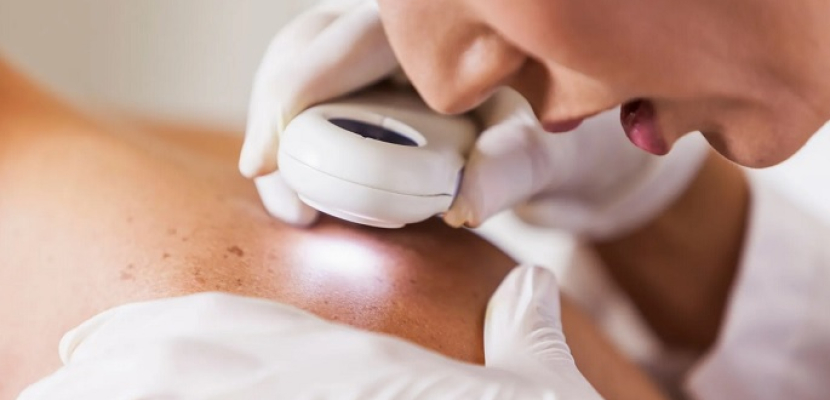 جلد اصطناعي لمحاربة مرض سرطان الجلد