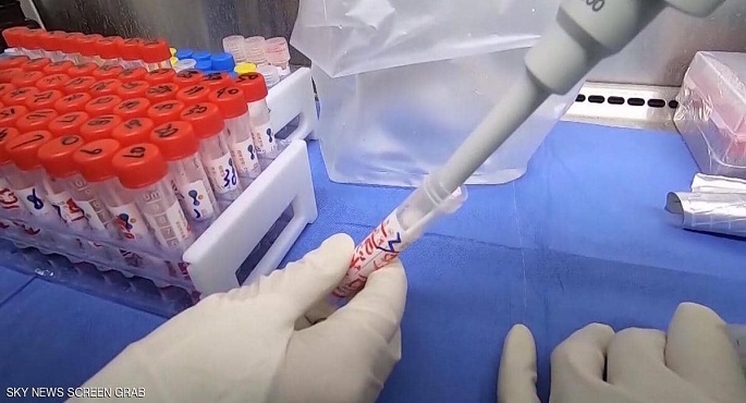 بعد الشفاء من كورونا.. دراسة تكشف طبيعة “الأجسام المضادة”