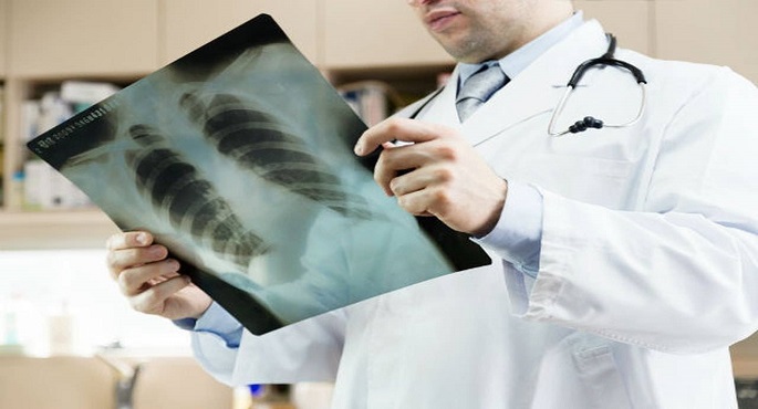علاج جدید للانسداد الرئوي المزمن بالتزامن مع الیوم العالمي للمرض
