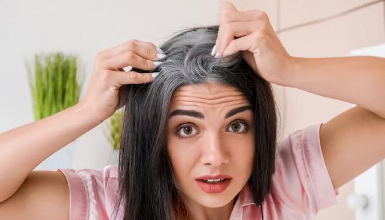 وصفات طبيعية للتخلص من الشيب المبكر فى الشعر