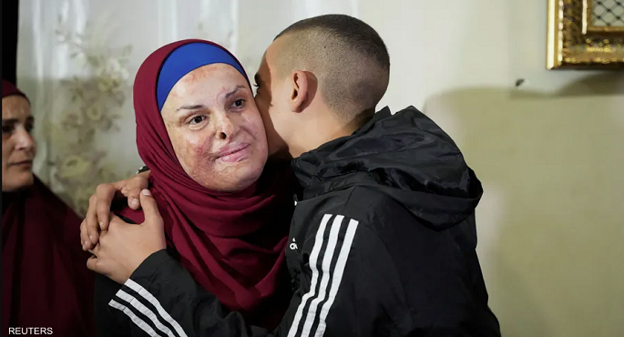 إسراء جعابيص .. حكاية مؤلمة لأسيرة فلسطينية