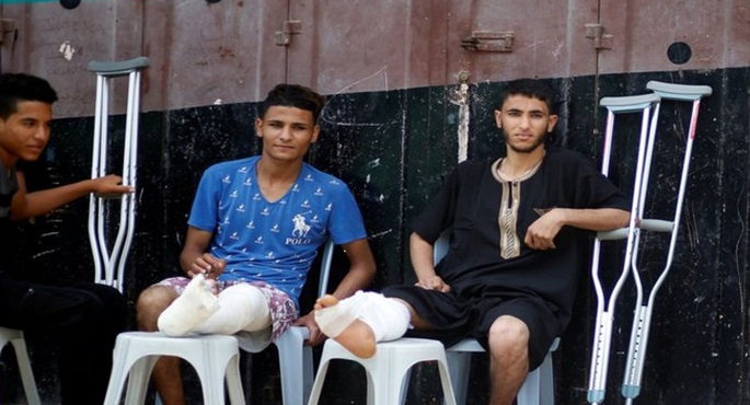 وول ستريت جورنال: مبتورو الأطراف في غزة يكافحون من أجل الحياة