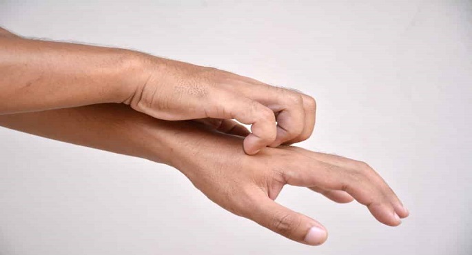 أسباب الحكة الجلدية المستمرة
