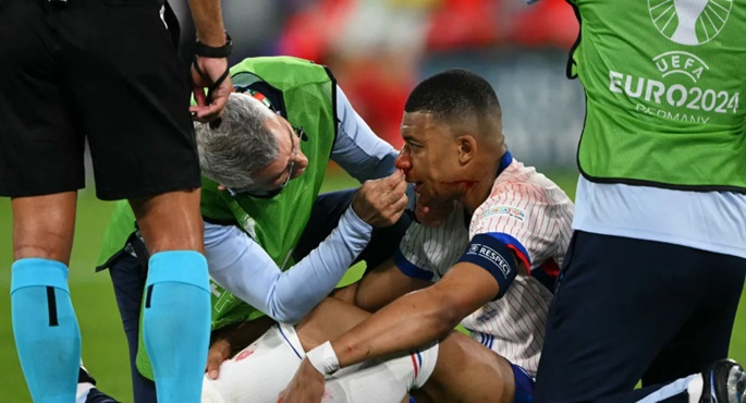 الاتحاد الفرنسي: مبابي يعاني من كسر في أنفه وسيكمل مباريات “يورو 2024” بقناع واقٍ