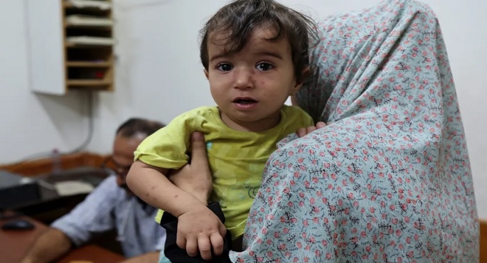 “الصحة العالمية”: تسليم 1.2 مليون جرعة من لقاح شلل الأطفال لغزة