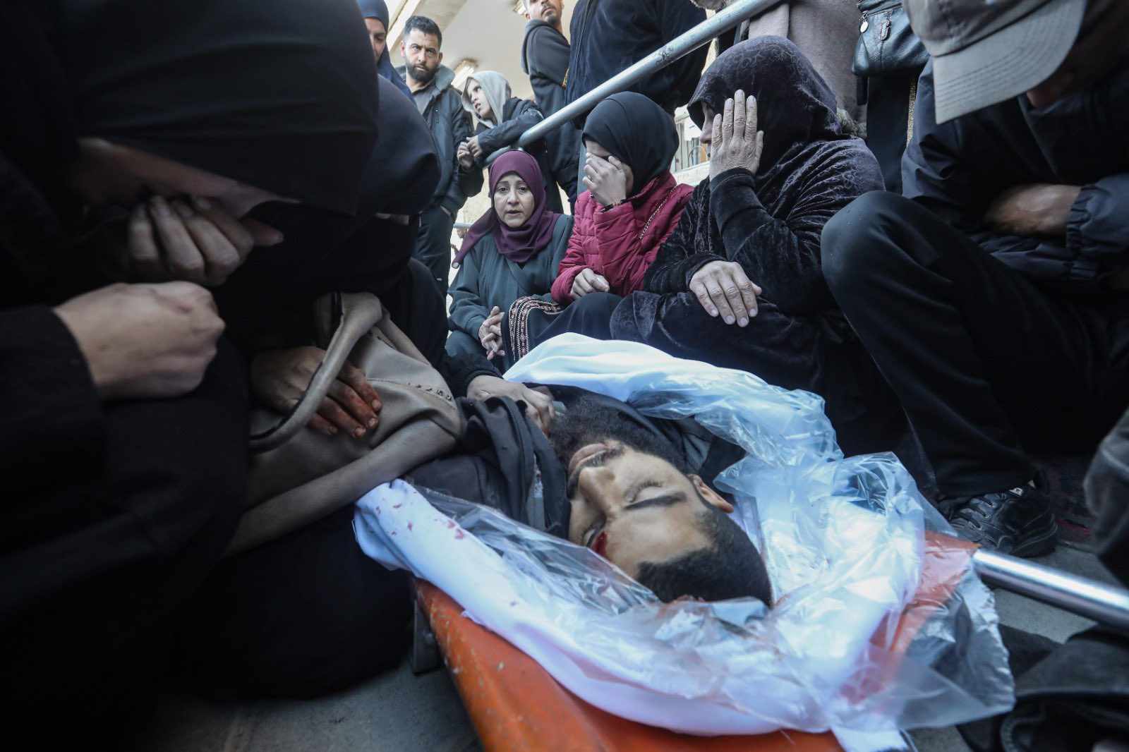 شهيدان ومصابون بنيران الاحتلال فى جنوب قطاع غزة