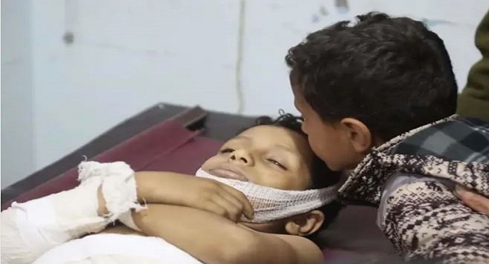 قتل وإصابة 4 أطفال في قصف لميليشيا الحوثي غرب تعز