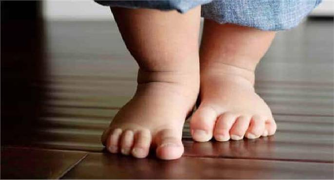 برودة أطراف الطفل تنذر بإصابته بمرض خطير
