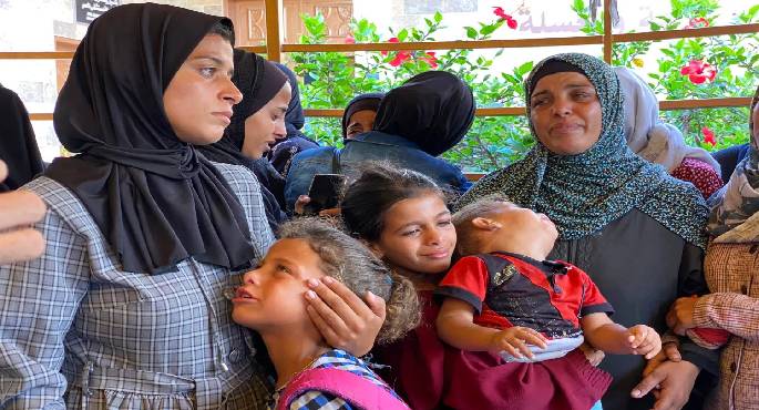 استشهاد فلسطينيين اثنين بسبب المجاعة وسوء التغذية فى قطاع غزة