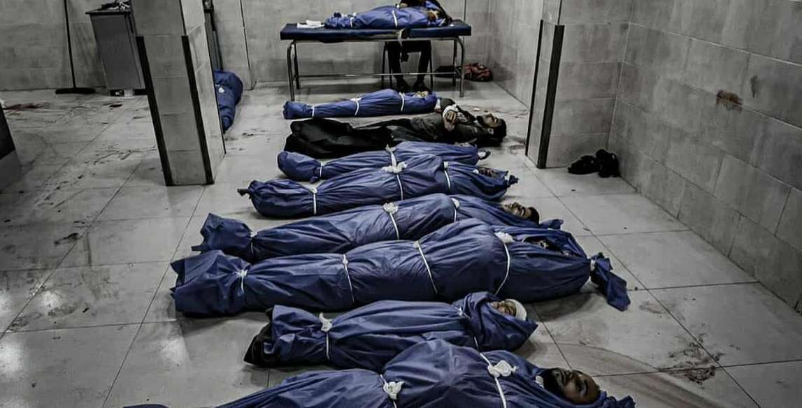 63 شهيدا في قصف الاحتلال لقطاع غزة بينهم 28 من منتظري المساعدات