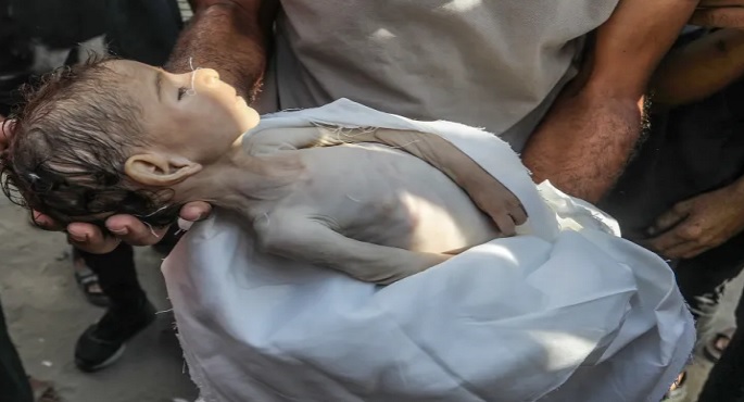 استشهاد 21 طفلا فلسطينيا بسبب سوء التغذية والمجاعة فى قطاع غزة خلال 72 ساعة