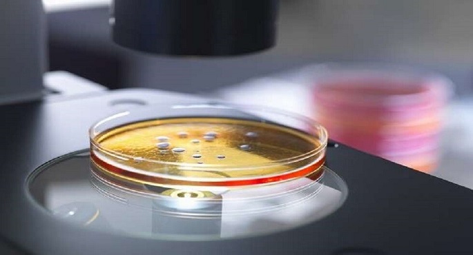 أمريكا تسجل زيادة فى معدلات الإصابة بـ”البكتيريا الكابوسية”